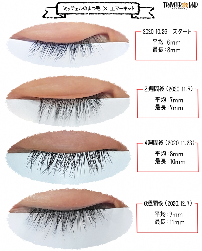 エマーキット まつげ美容液 6本 | hartwellspremium.com